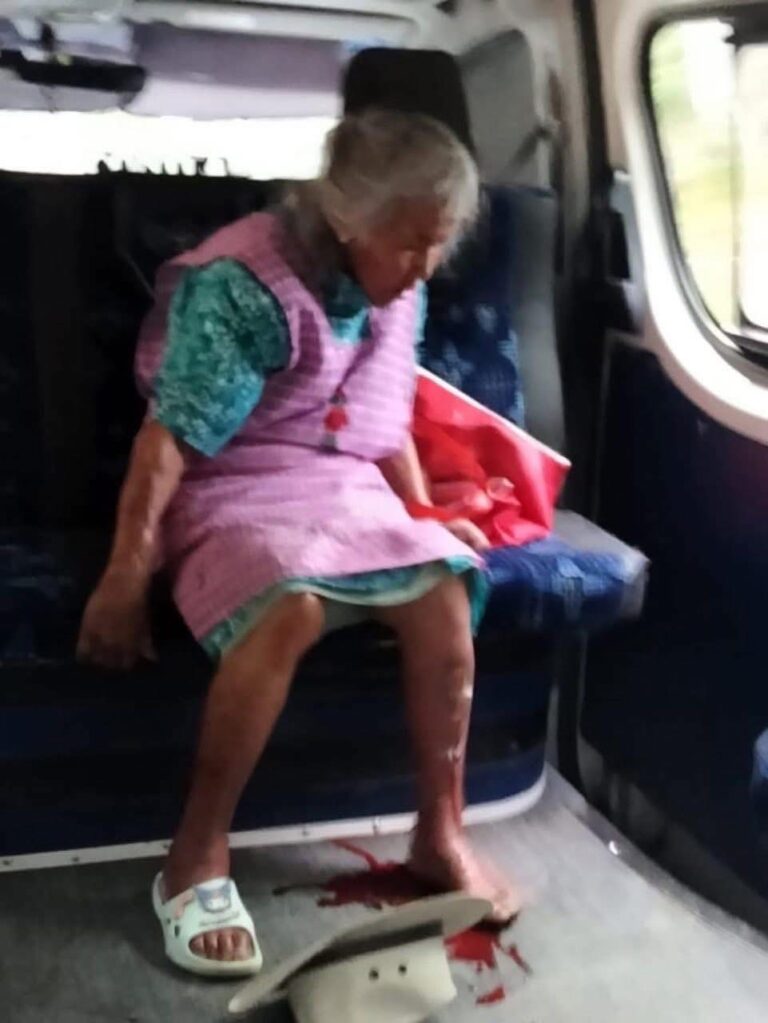 Chofer de colectiva acelera y lesiona a adulta mayor en Tlaxcala; SMyT actúa tras denuncia en redes